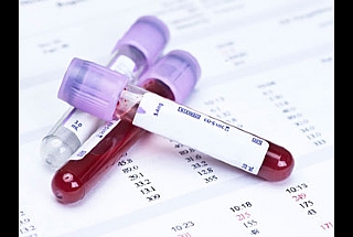 הכל על בדיקות דם בגיל שנה