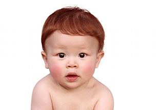 אדמדמת אביבית - איך להקל על תסמיני המחלה?