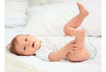 כל השיטות היעילות נגד יתושים לתינוקות