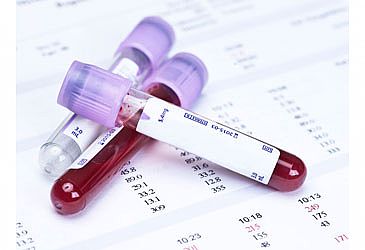 הכל על בדיקות דם בגיל שנה הכל על בדיקות דם בגיל שנה