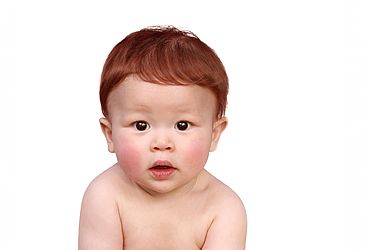 אדמדמת אביבית - איך להקל על תסמיני המחלה? אדמדמת אביבית - איך להקל על תסמיני המחלה?