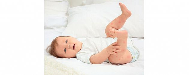 כל השיטות היעילות נגד יתושים לתינוקות