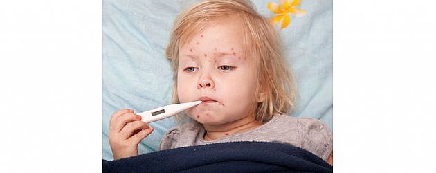 הכל על אבעבועות רוח